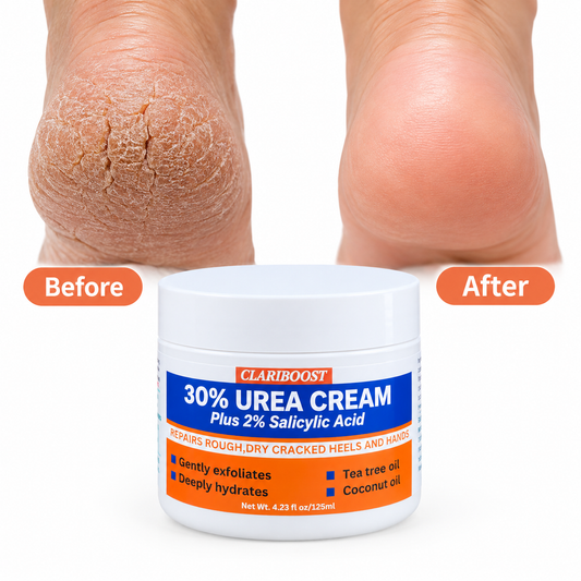 urea moisturiser